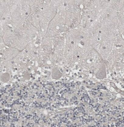 ZNF277 Antibody - BSA Free