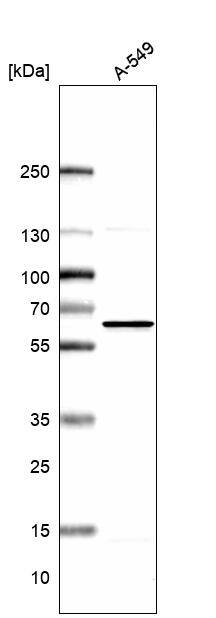 NMT1 Antibody Western Blot: NMT1 Antibody [NBP1-82548]