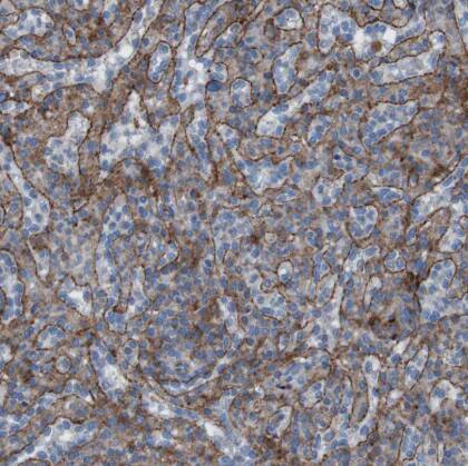 RNF182 Antibody
