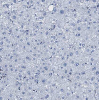 RNF182 Antibody