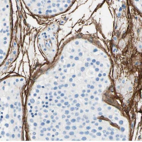 MAGP-2/MFAP5 Antibody