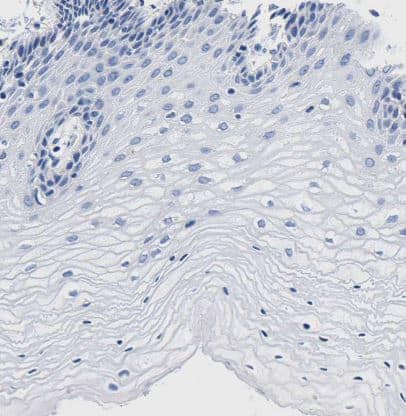 LSECtin/CLEC4G Antibody