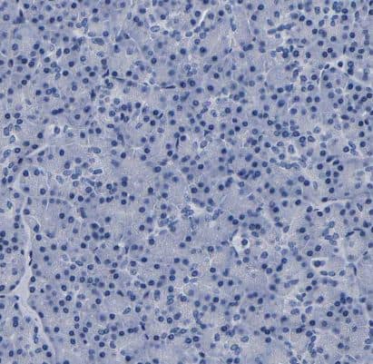 LSECtin/CLEC4G Antibody