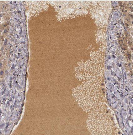 LRG1 Antibody