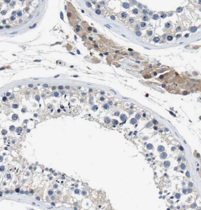 Kv7.5 Antibody - BSA Free