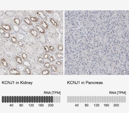 KCNJ1 Antibody