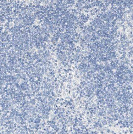 KCNJ1 Antibody