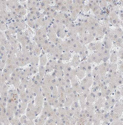 KCNJ1 Antibody