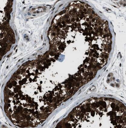 NUDCD3 Antibody - BSA Free