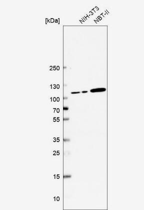 Jade-1/PHF17 Antibody - BSA Free
