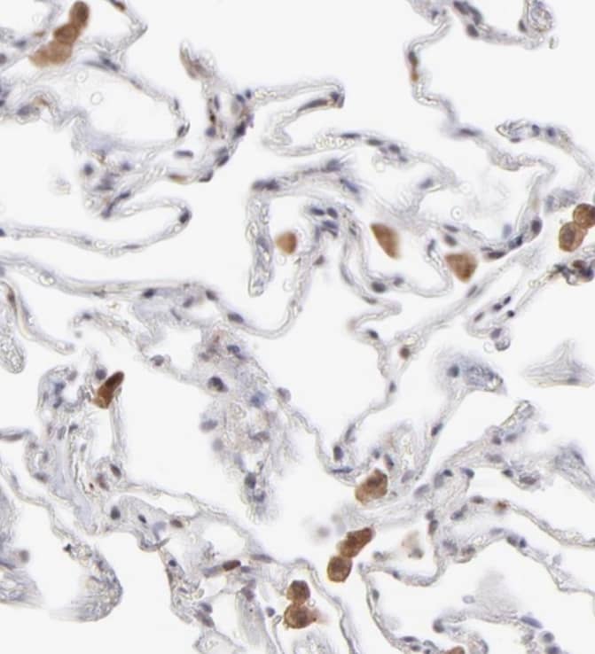 OAS1 Antibody - BSA Free