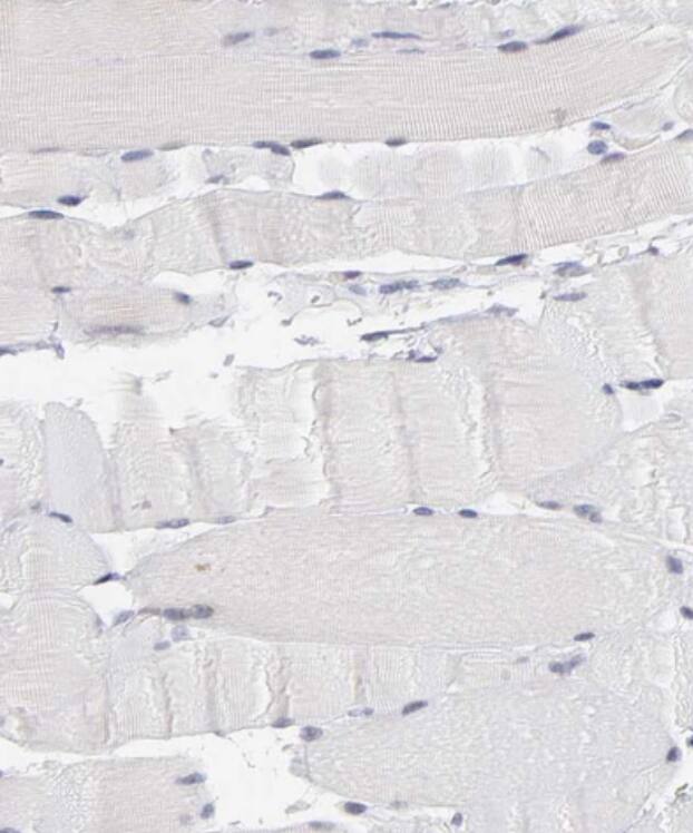 OAS1 Antibody - BSA Free