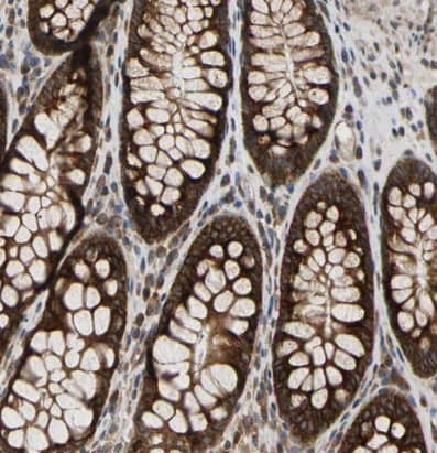 VAP-A Antibody - BSA Free