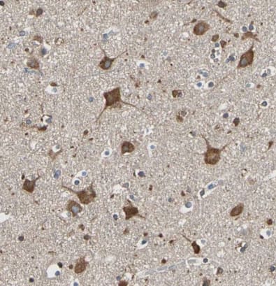 VAP-A Antibody - BSA Free