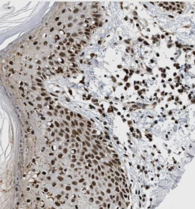 RBM5 Antibody - BSA Free