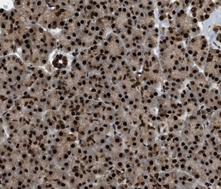 RBM5 Antibody - BSA Free