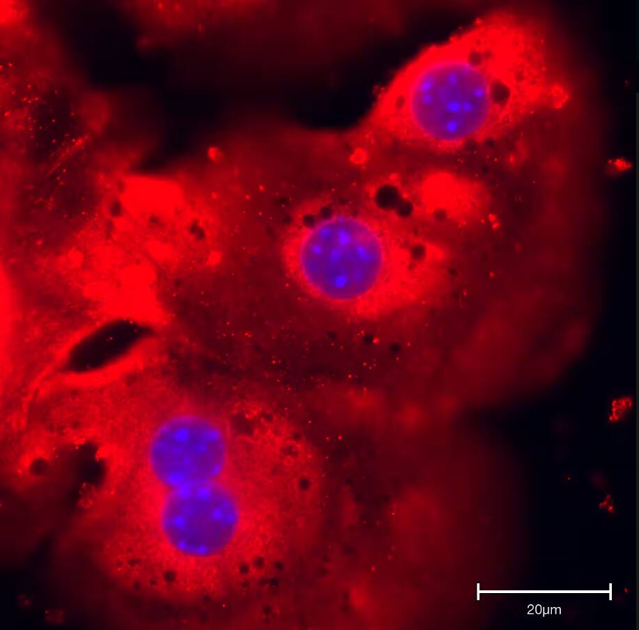 N-Acetylglucosaminyltransferase V/MGAT5 Antibody