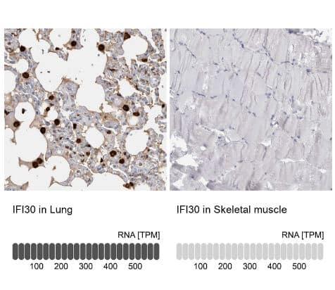 GILT/IFI30 Antibody