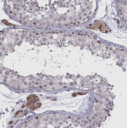 CHST8 Antibody