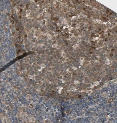 QSER1 Antibody - BSA Free