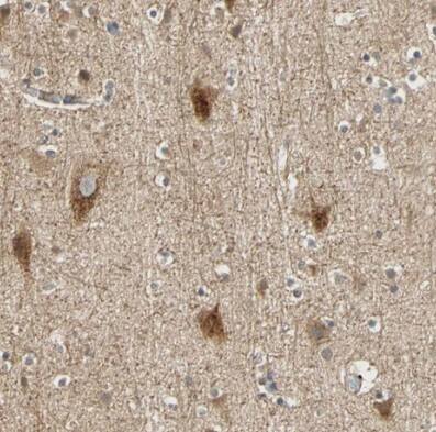 QSER1 Antibody - BSA Free