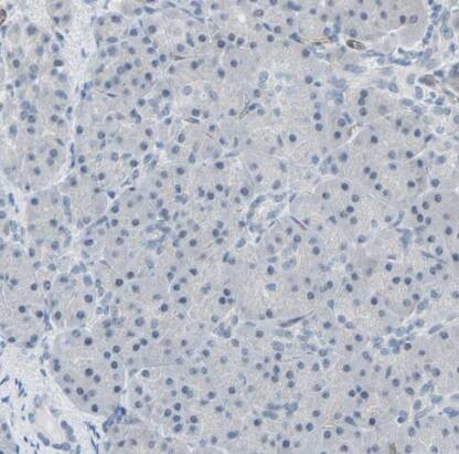 QSER1 Antibody - BSA Free