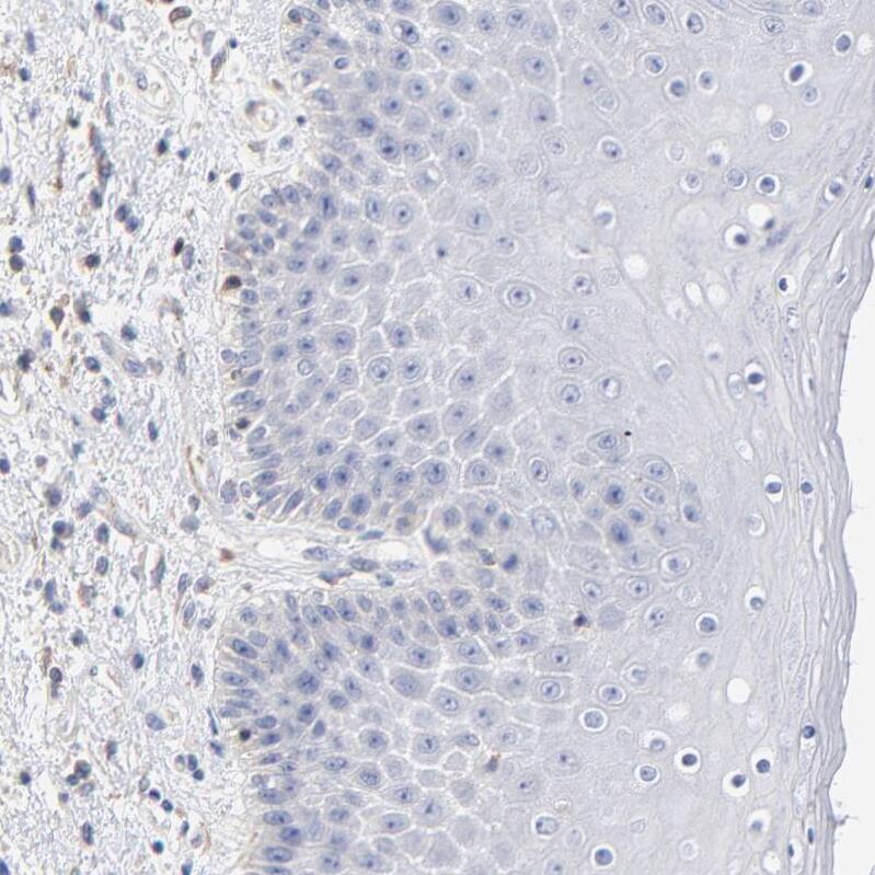 Septin-11 Antibody Immunohistochemistry-Paraffin: Septin-11 Antibody [NBP1-83824]
