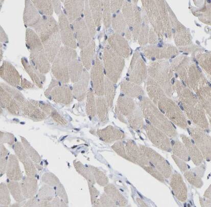 NLE1 Antibody