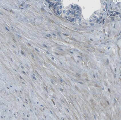 LRRN1/NLRR-1 Antibody - BSA Free
