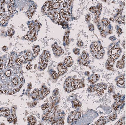MMRN2 Antibody