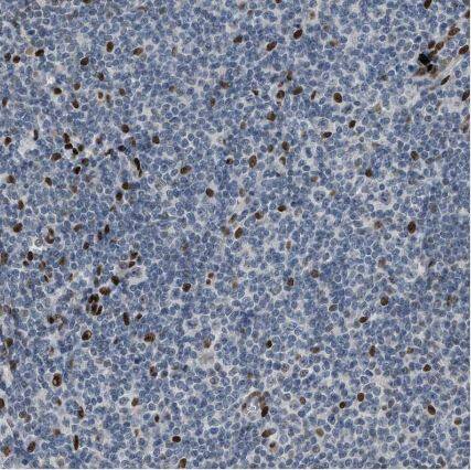 ZBTB20 Antibody