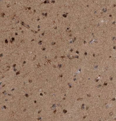 RAB3GAP2 Antibody