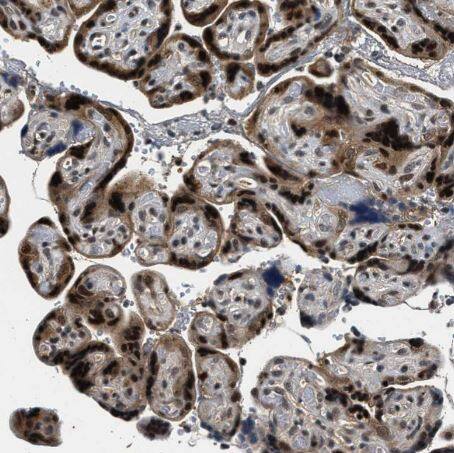 RBM33 Antibody
