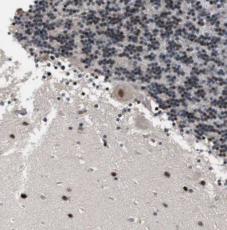 RBM33 Antibody