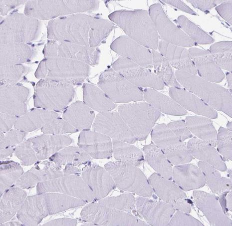 Defensin alpha 5 Antibody