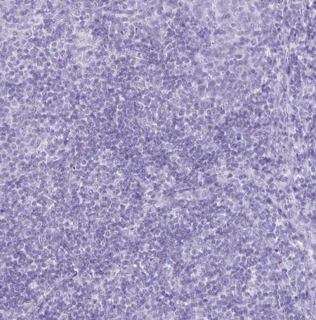 Defensin alpha 5 Antibody