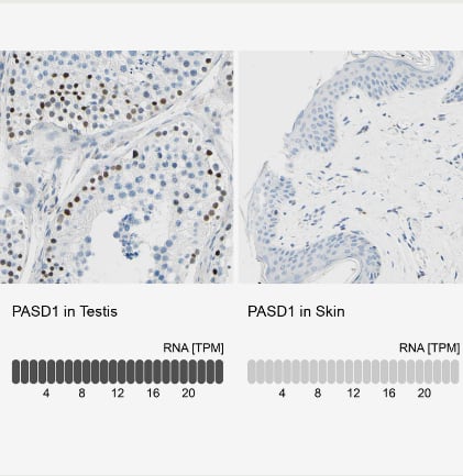 PASD1 Antibody