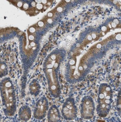 MPDU1 Antibody