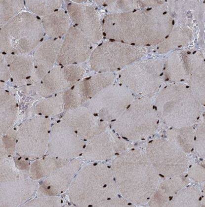 WBP4 Antibody