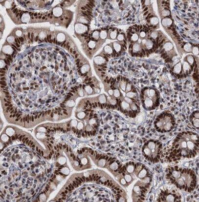 WBP4 Antibody