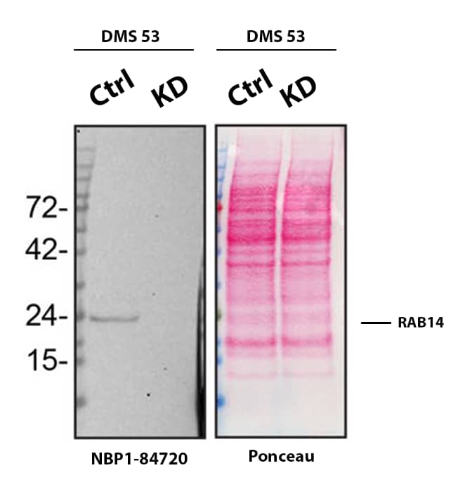 RAB14 Antibody - BSA Free Western Blot Shows RAB14 Specificity Using Knockdown Cell Line.