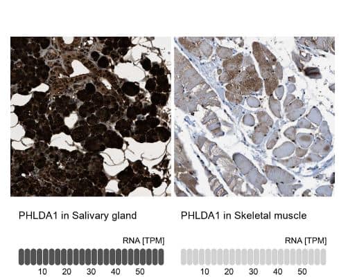 PHLDA1 Antibody