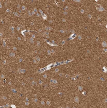 Dematin Antibody - BSA Free