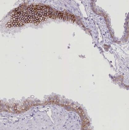 SLC39A10 Antibody