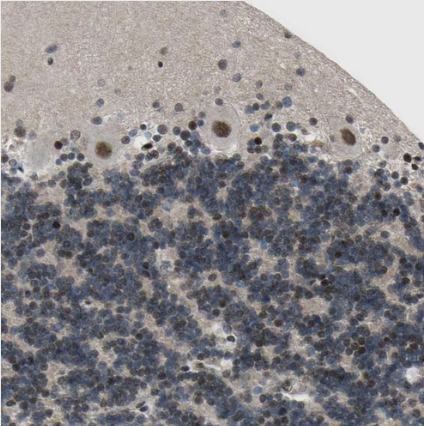 PRKRIR Antibody - BSA Free