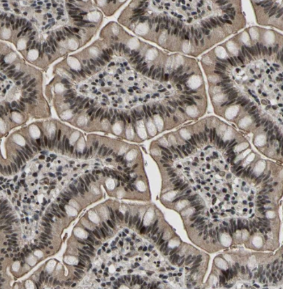 PRKRIR Antibody - BSA Free