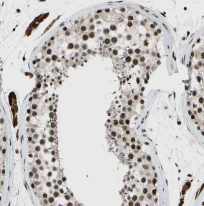 PRKRIR Antibody - BSA Free