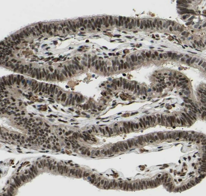 PRKRIR Antibody - BSA Free