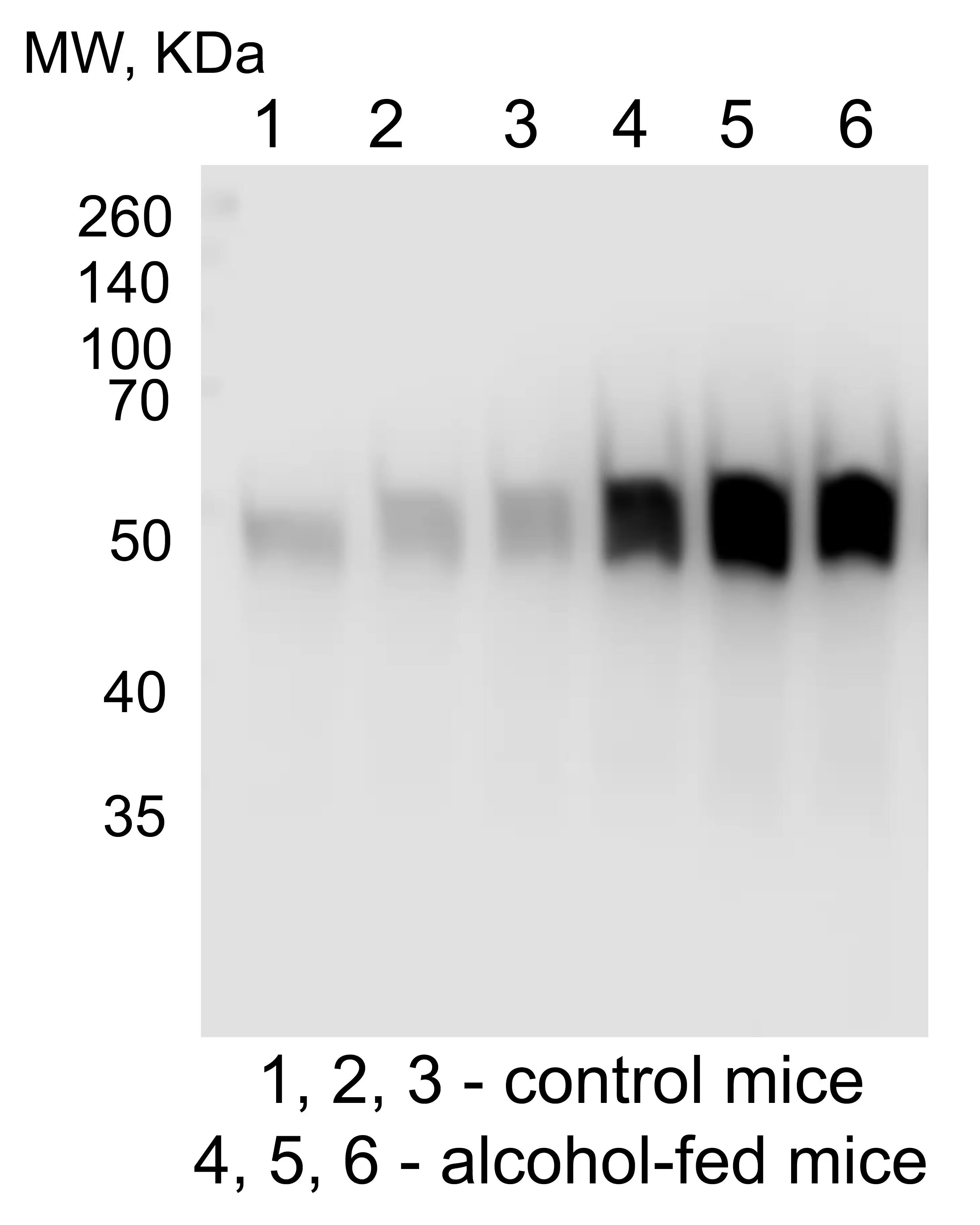 Cytochrome P450 2E1 Antibody