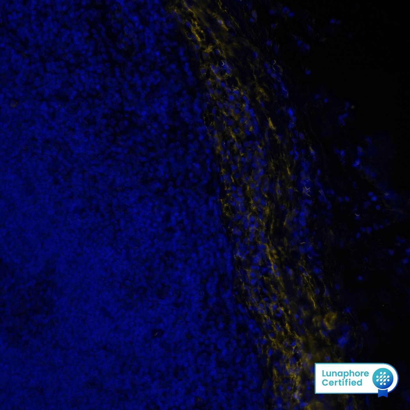 Versican Antibody - BSA Free